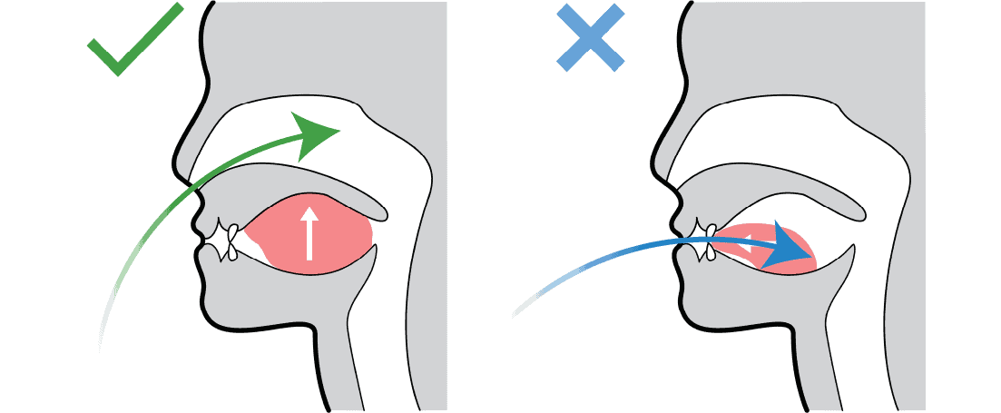 Diagram comparing nasal breathing with the tongue on the palate versus mouth breathing with an open mouth
